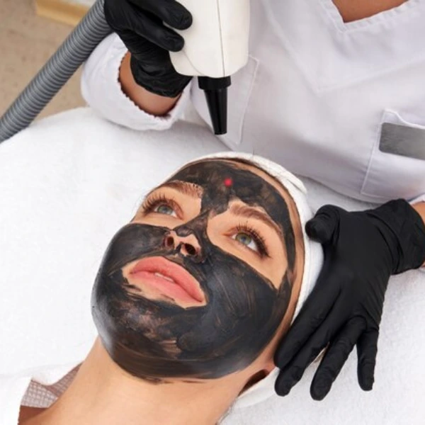 Carbon Laser Facial 3 DBC 68