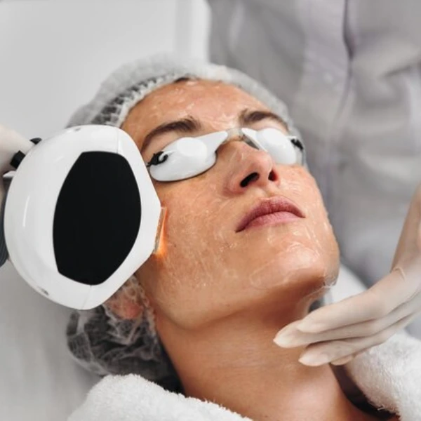 Photo Facial 4 DBC 73