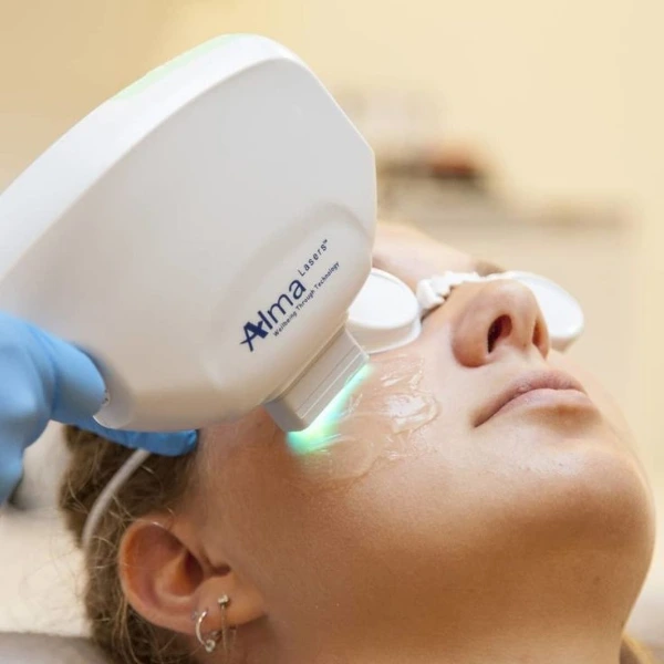 Photo Facial 1 Photofacial – Brighten & Rejuvenate Your Skin