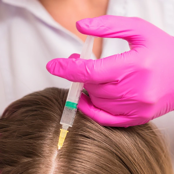 Mesotherapy for Hair 2 Mesotherapy for Hair – Reduce Hair Fall & Boost Growth