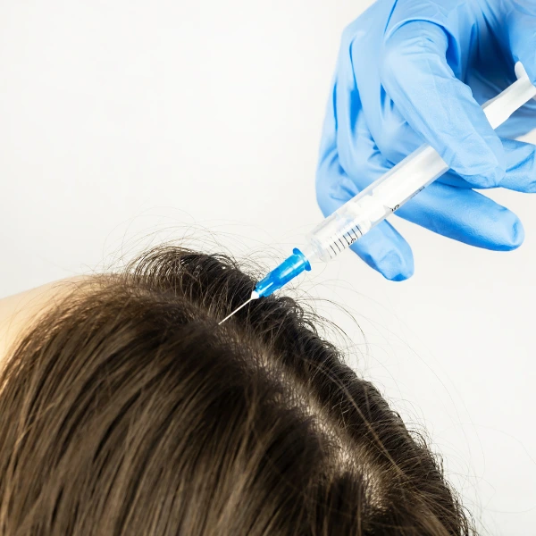 Mesotherapy for Hair 3 Mesotherapy for Hair – Reduce Hair Fall & Boost Growth