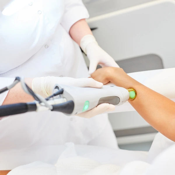 Permanent Laser Hair Removal Treatment 4 permanent hair removal laser treatment in delhi by dua beauty cosmetics