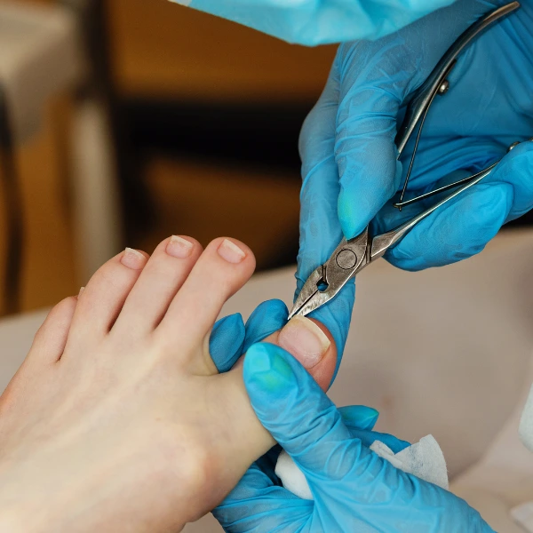 Medi Pedicure 3 Medical Pedicure – Expert Foot & Nail Care