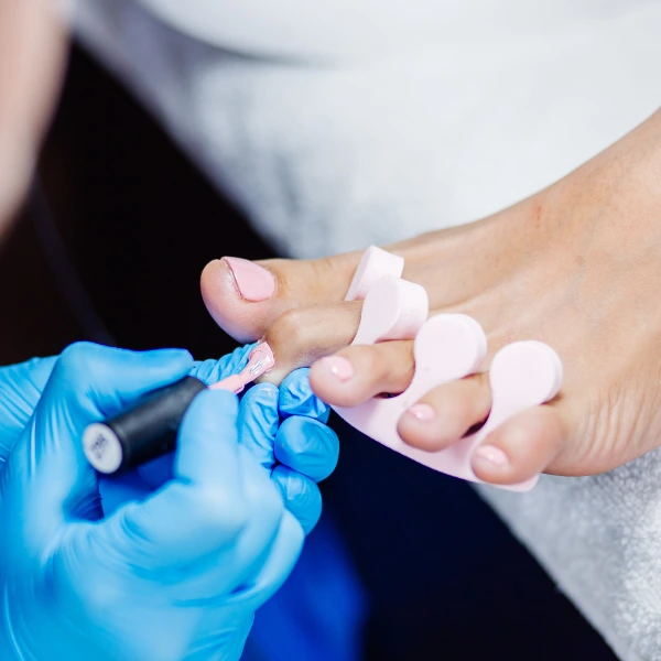 Medi Pedicure 1 Medical Pedicure – Expert Foot & Nail Care