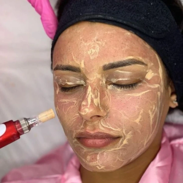 BB Glow Treatment 2 BB Glow Treatment in Delhi – Get Radiant Skin