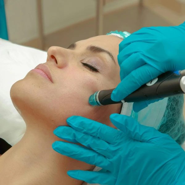Face PRP 2 Face PRP Treatment in Delhi – Rejuvenate Your Skin Naturally