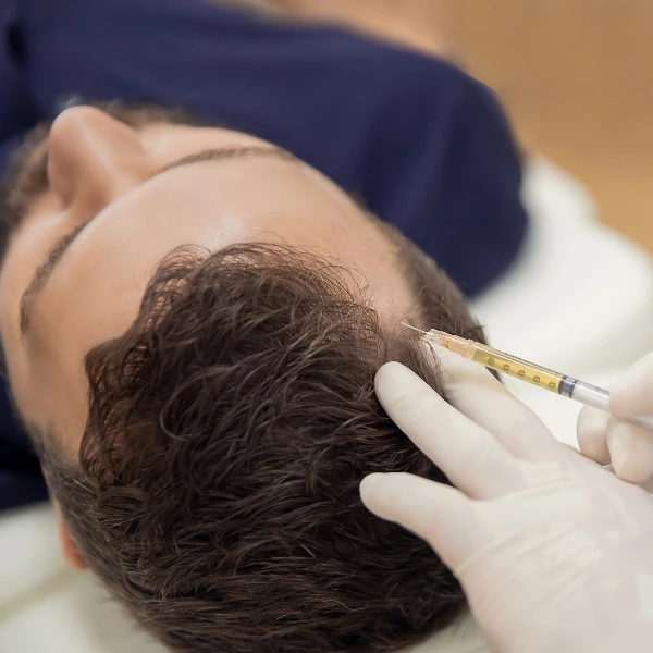 PRP for Hair Loss 4 Regrow stronger, healthier hair with PRP for hair loss at Dua Beauty Cosmetics. Clinically proven, non-surgical treatment by expert specialists in Delhi.