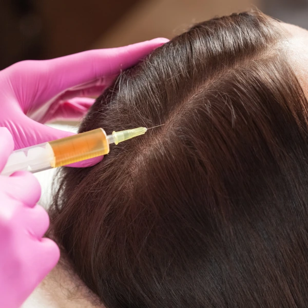 PRP for Hair Loss 2 Hair Botox Treatment Cost in India – Prices, Benefits & Results (2025)