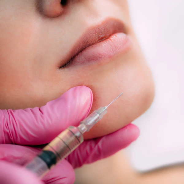 Chin Filler 3 Chin Filler Treatment in Delhi | Sculpted, Defined Chin Enhancement