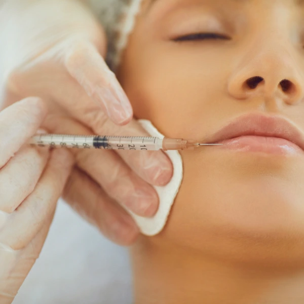 Lip Filler 2 Lip Fillers Treatment in Delhi | Fuller, Natural-Looking Lips – Dua Beauty Cosmetics