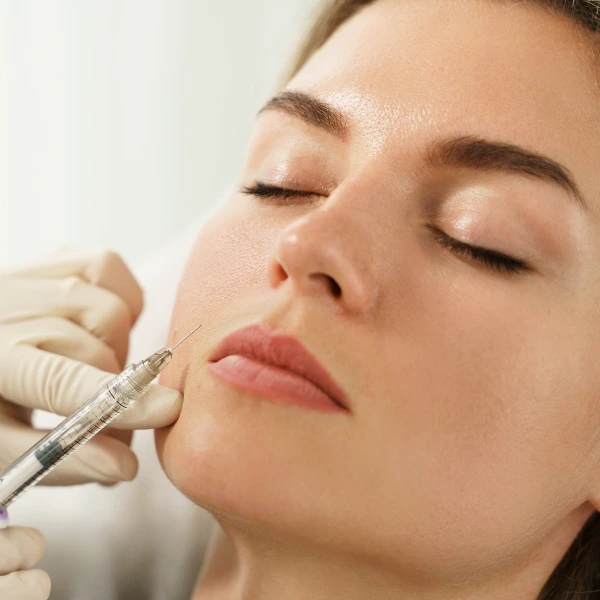 Cheek Filler 2 Cheek Fillers in Delhi | Non-Surgical Mid-Face Contouring