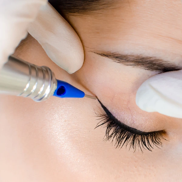Permanent Eyeliner 1 Permanent Eyeliner in Delhi | Smudge-Proof Eyeliner Tattoo